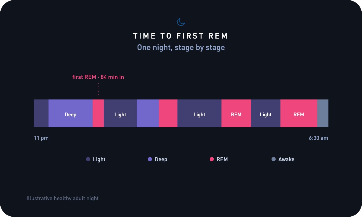 Typical Time to first REM ranges